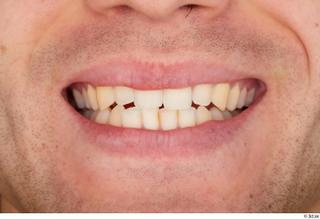 Tomas Salek teeth 0001.jpg